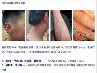 揭秘基孔肯雅热“后遗症”：影响与应对策略